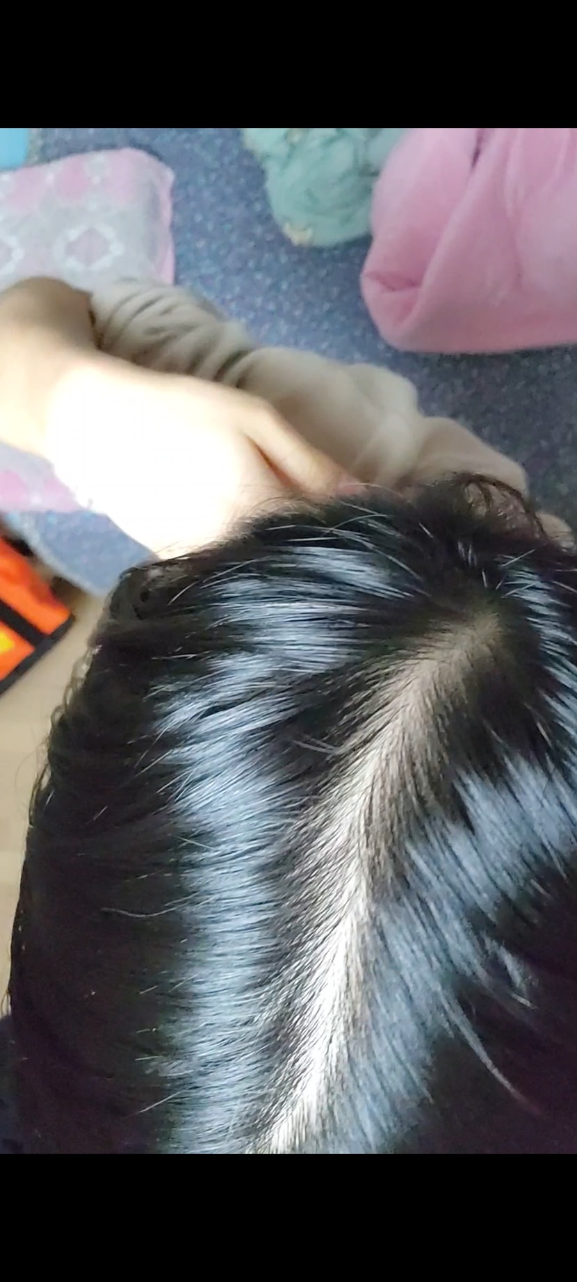 정수리 라인