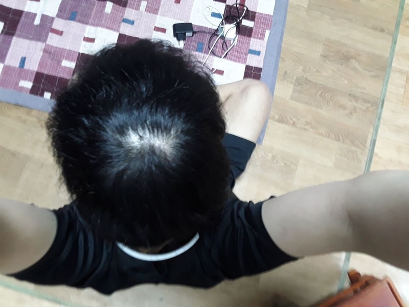 좀 나아지고 있는걸까요..?