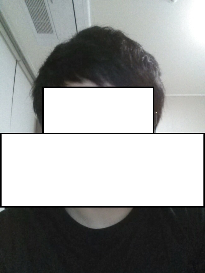 가리고 다닐때 머리 지금