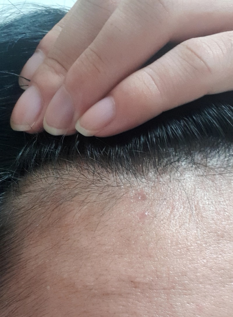 M자탈모인가요?확인부탁드립니다 형들