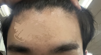 이마..