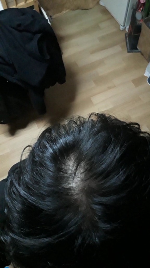 3/16일 일반 조명 아래