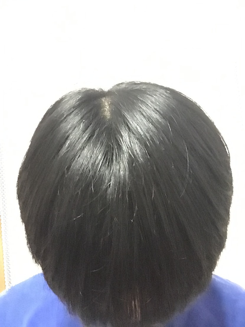 고개 숙이고 찍은거사진이 왼쪽으로 90도 회전됐네