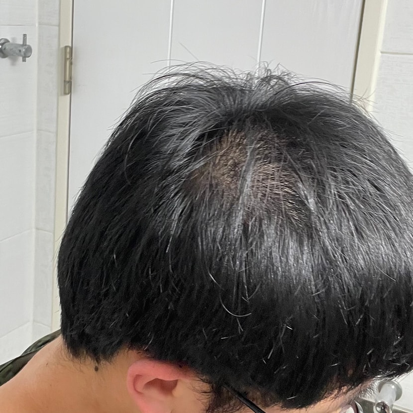 왼쪽이 심함