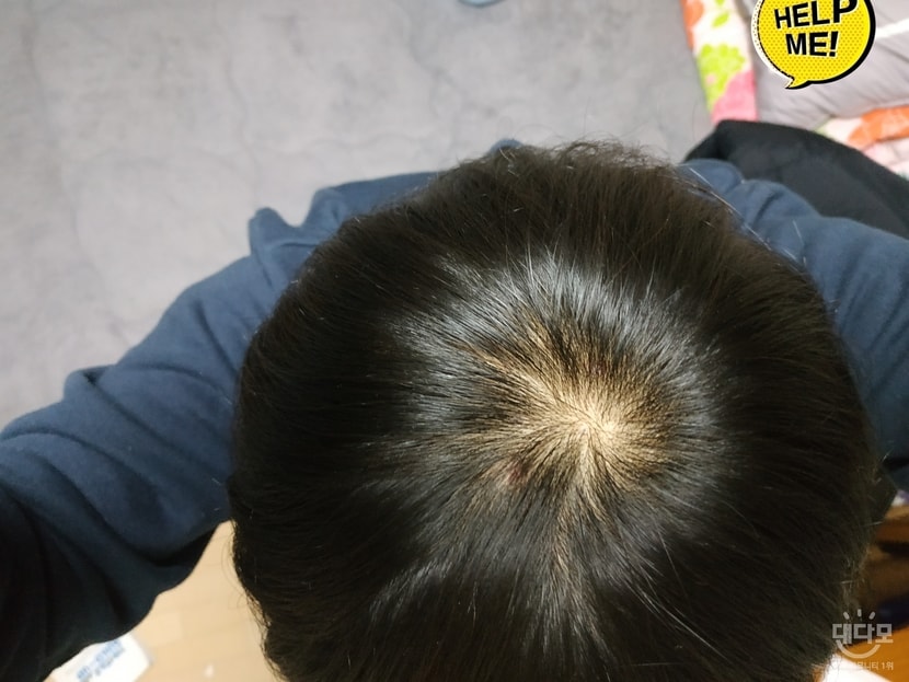 1개월