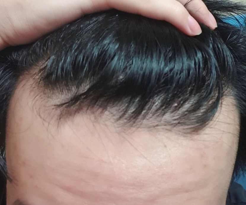 이마 정면