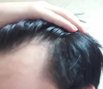 이마 오른쪽