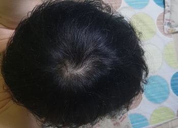 삭발하기전(8개월 전)
