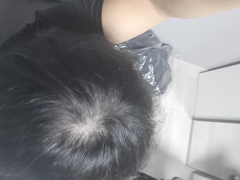 이거 내머리임