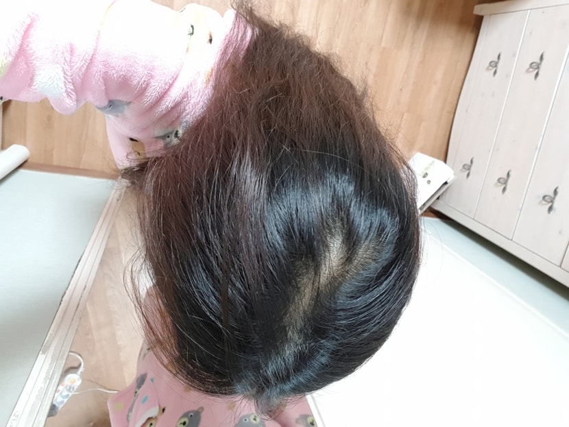 풀었을 때
