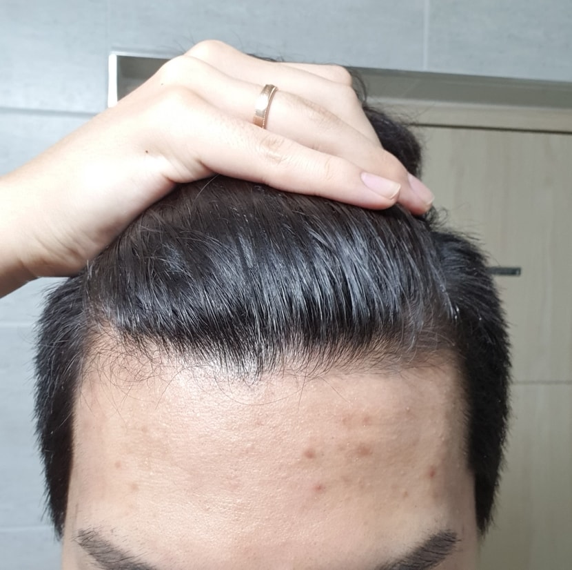 마이시아 복용사진