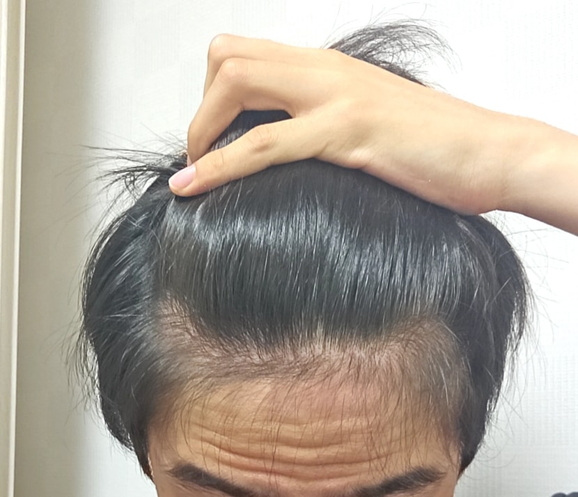 현재