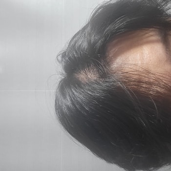 빛 강한곳