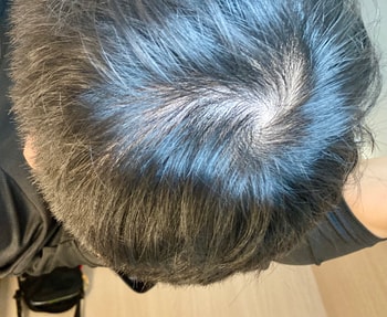 뒤