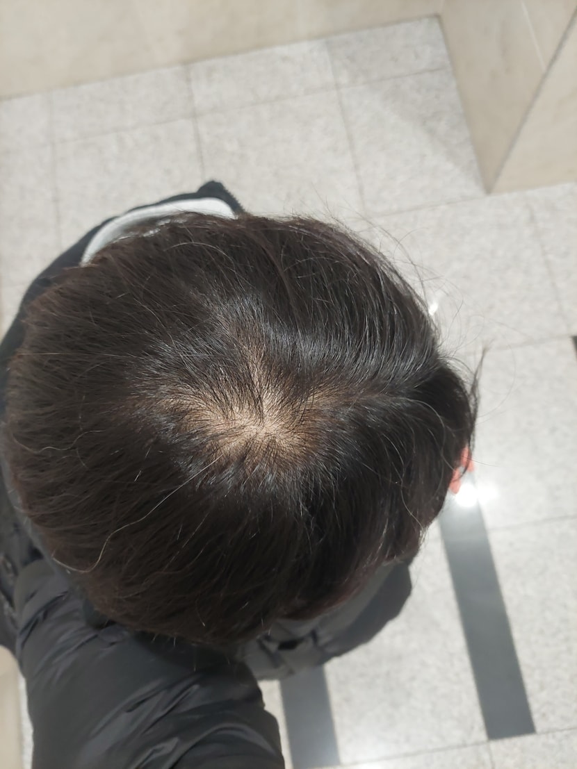 2번