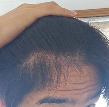 복약후입니다