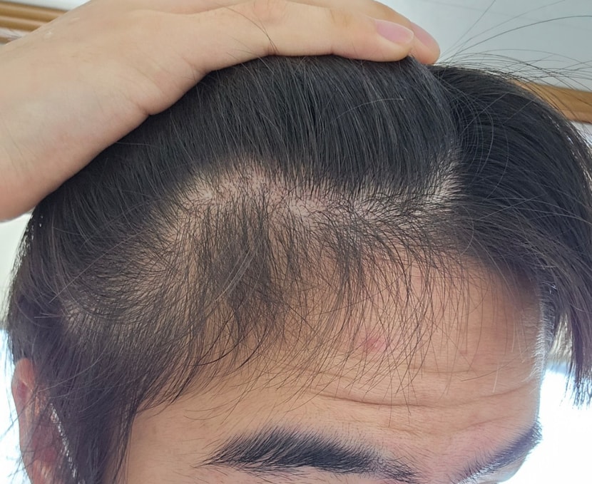 복약전