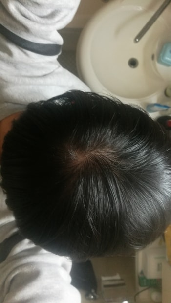 6개월째