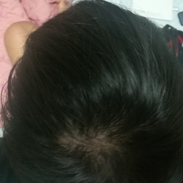 현재 10월30일 3개월차