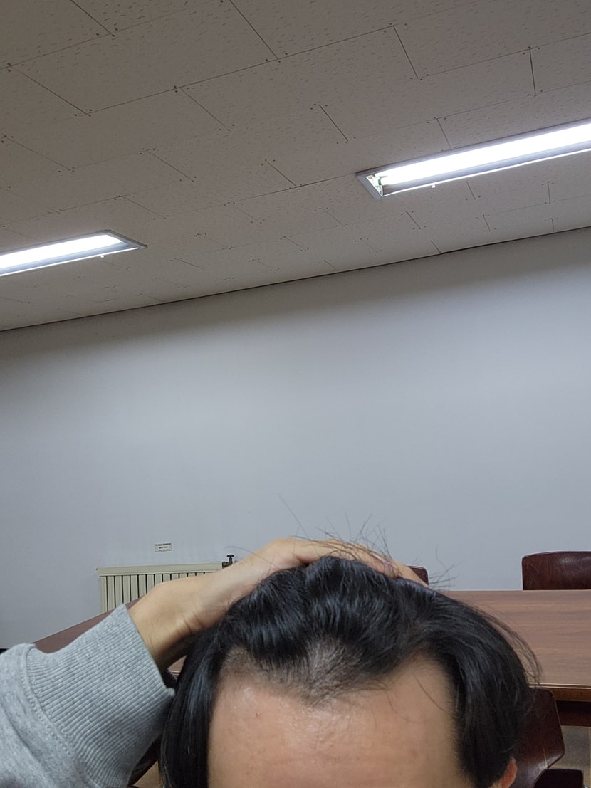 현재 머리 상태