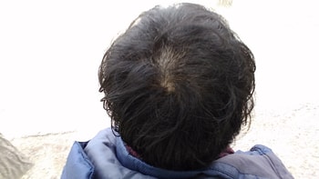 3일전 (3개월 복용)