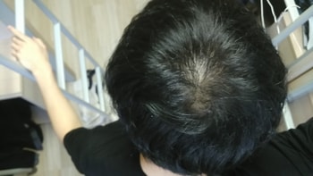 방금찍은사진 (3개월 복용)