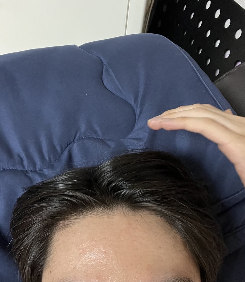 탈모인가요