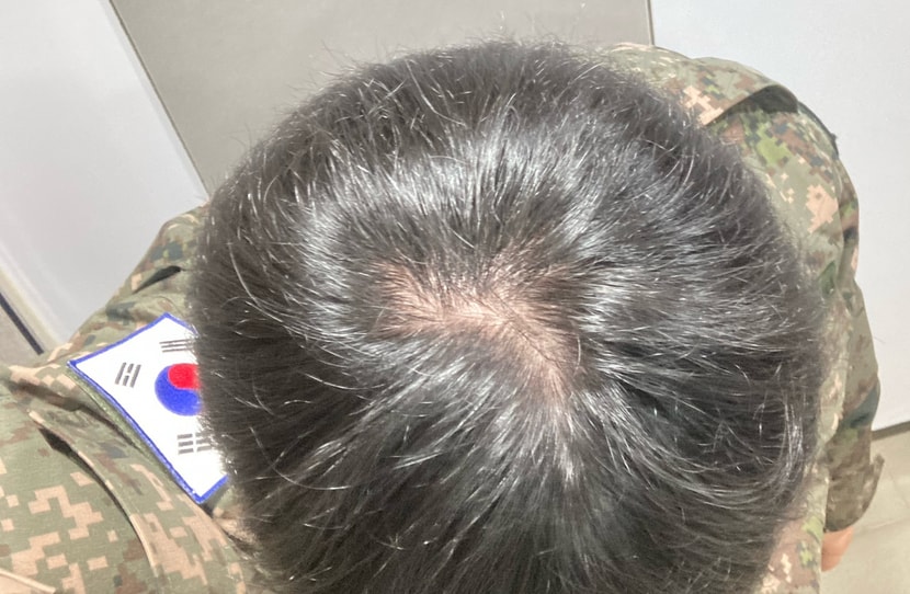 참고로 민간병원 갈수있음