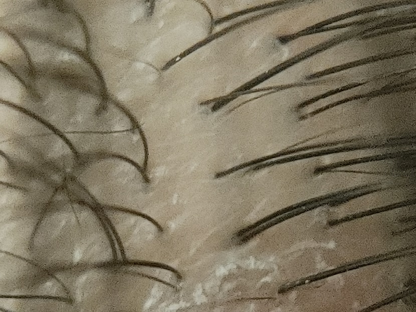정수리 확대 사진 3