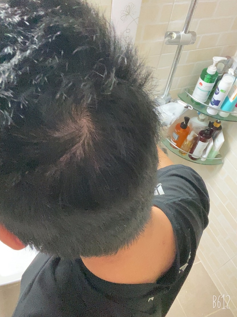 오늘 머리 안감은사진