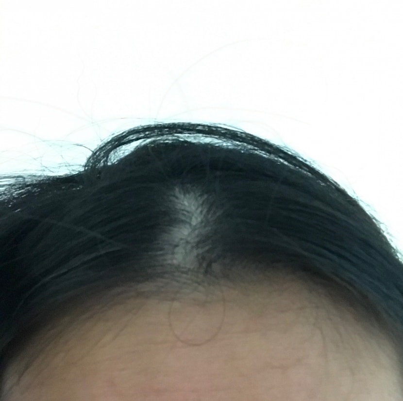 현재 가르마 정수리 상태1