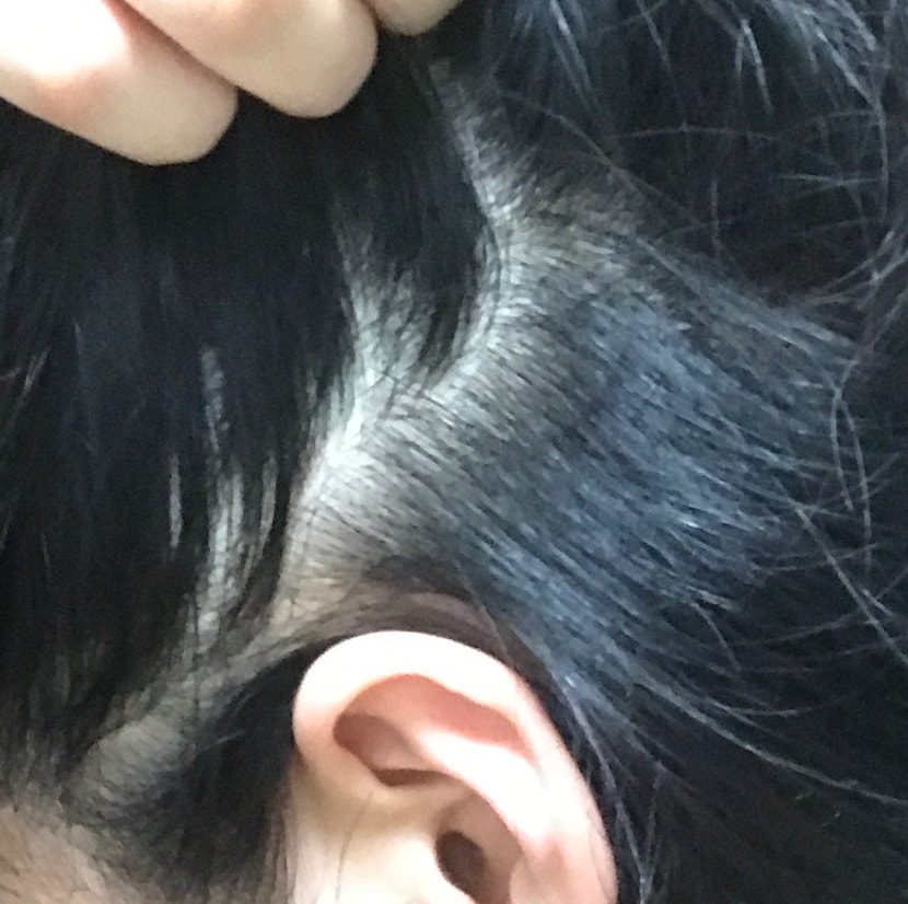 현재 옆머리나 속 상태1