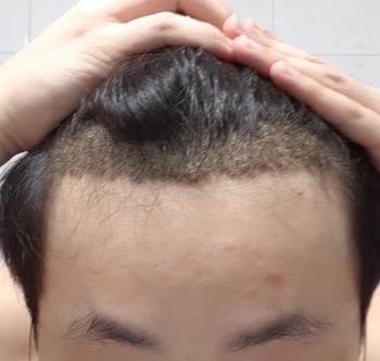 떼기 전 날