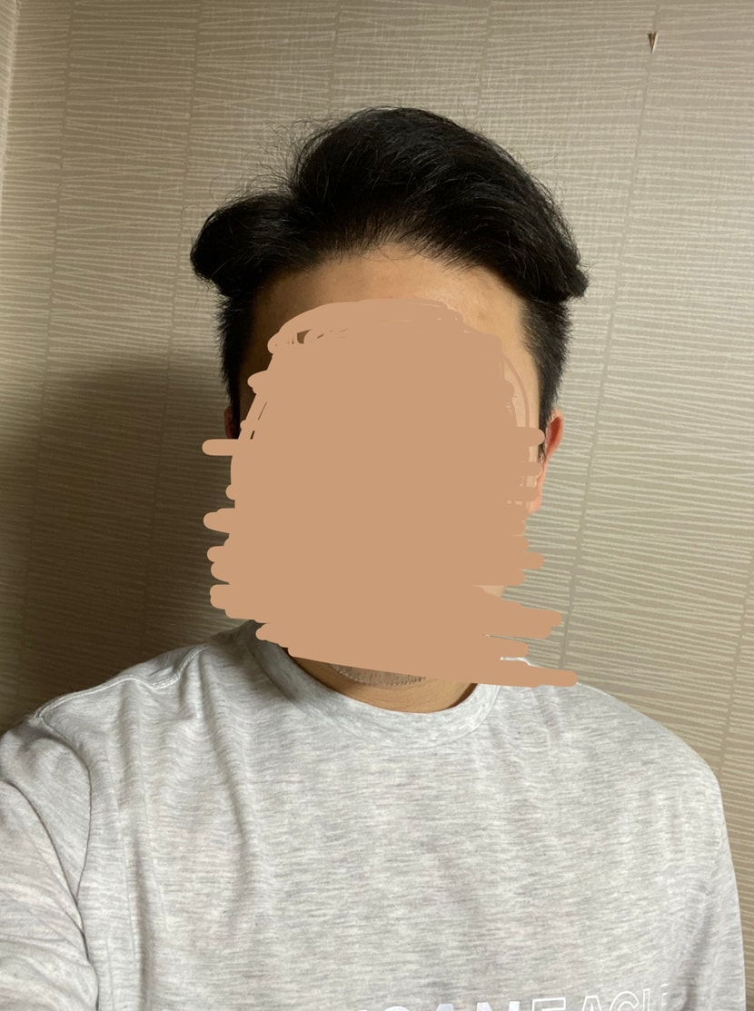 근데 앞은 나쁘지 않단 말이지..?