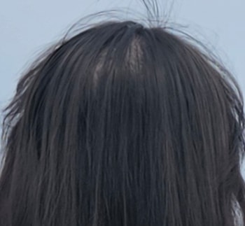 최근 다이어트 후