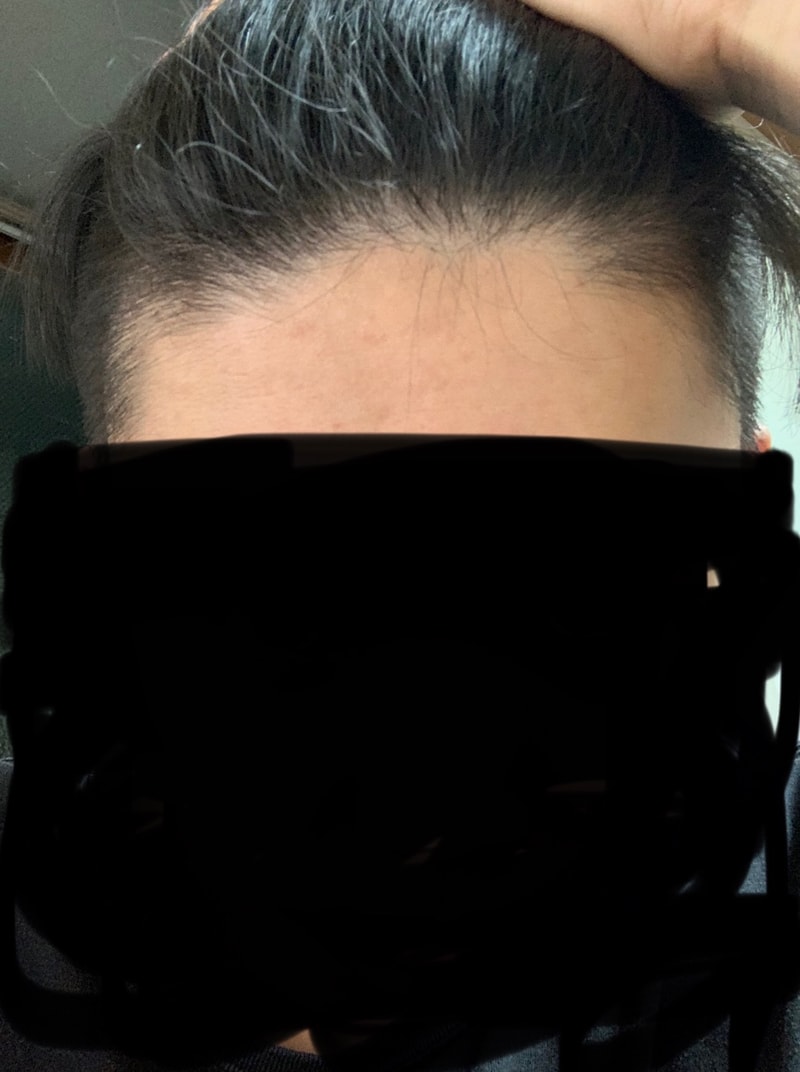 m자, 정수리 진단좀...