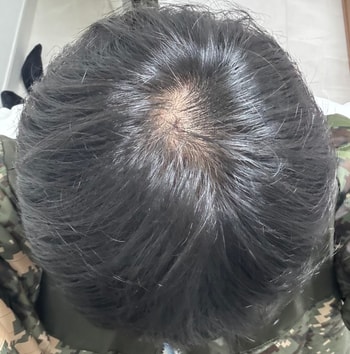 가르마 안 탔을 때