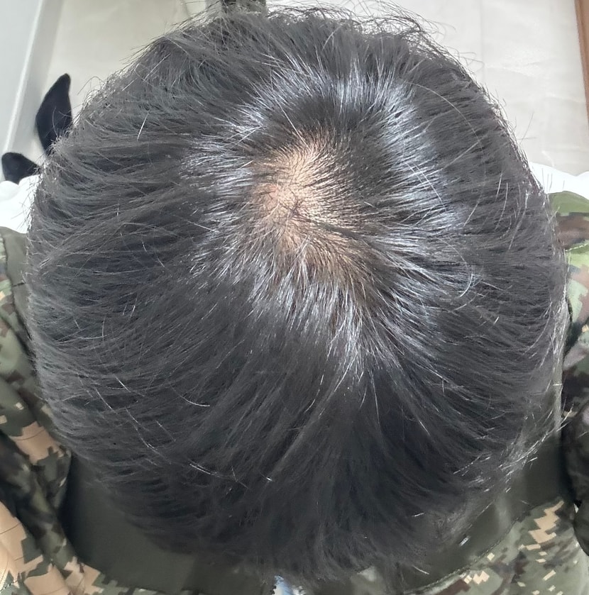 가르마 안 탔을 때
