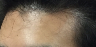 오른쪽