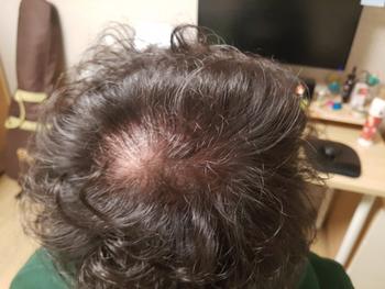 숱 너무 많이 털림...