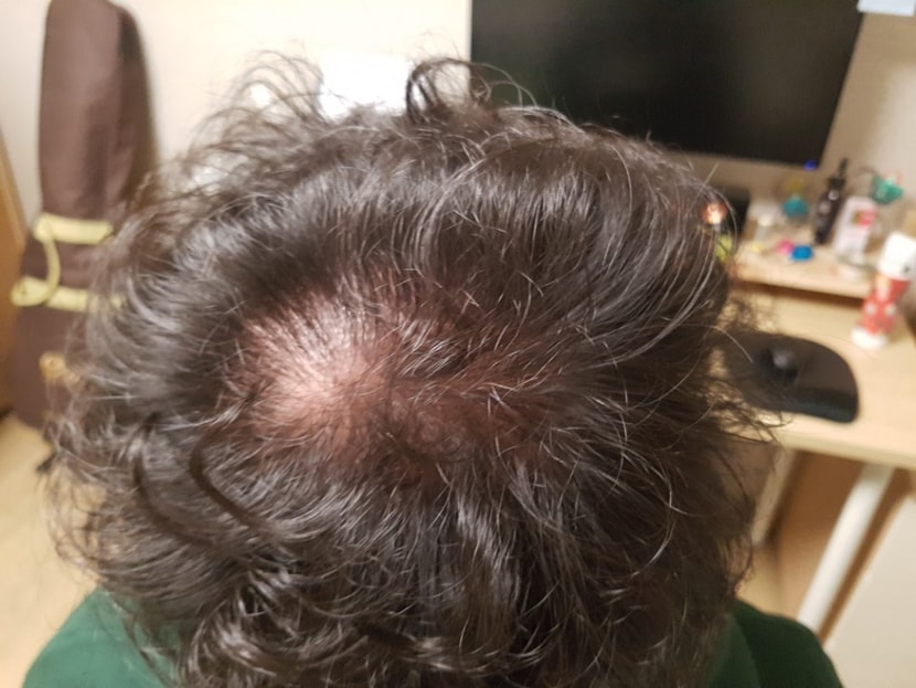 숱 너무 많이 털림...