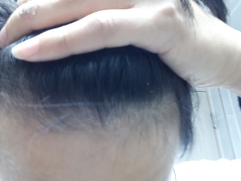 전체