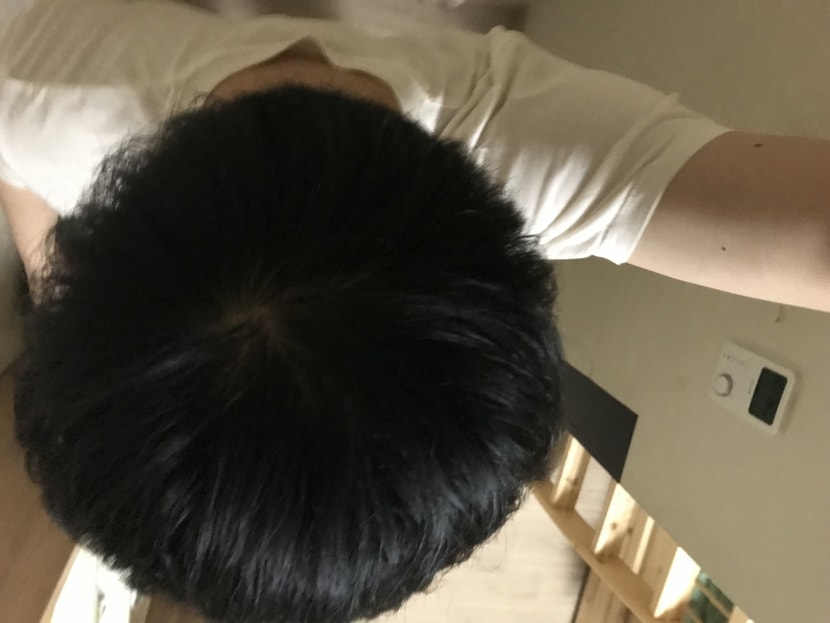 이건 빛안받는데