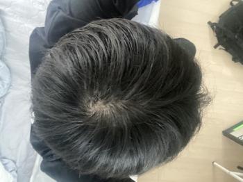 정수리