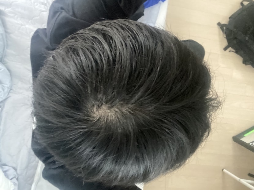정수리