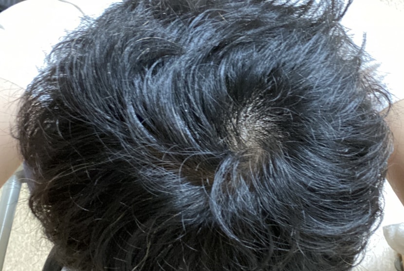 240일 차 (플래시)