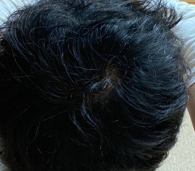 240일 차 (노 플래시)