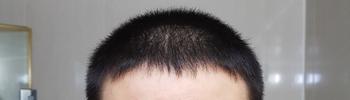 정면