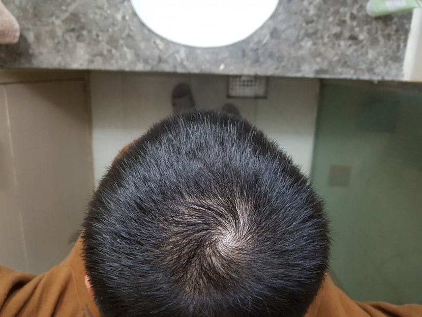 정수리