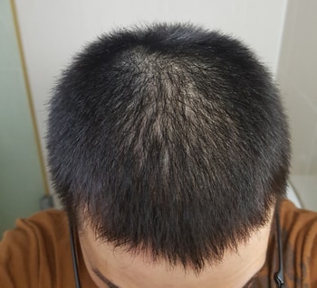 대각선